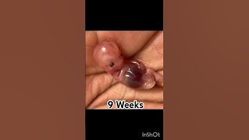 pregnancy journey #viralshortfeed #pregnant #pregnancysymptoms #baby