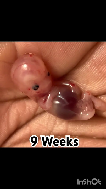 pregnancy journey #viralshortfeed #pregnant #pregnancysymptoms #baby