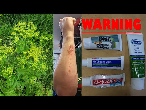Video: Wild Parsnip Burns: Gejala, Pengobatan, Dan Pencegahan