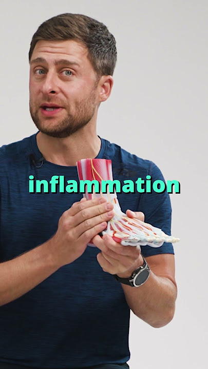 Avoid R.I.C.E for a sprained ankle