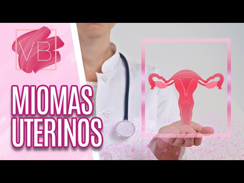 Vídeo: Miomas Uterinos Intersticiais - Sintomas, Causas E Tratamento