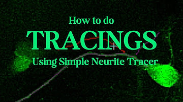 Neurite Tracings using SNT