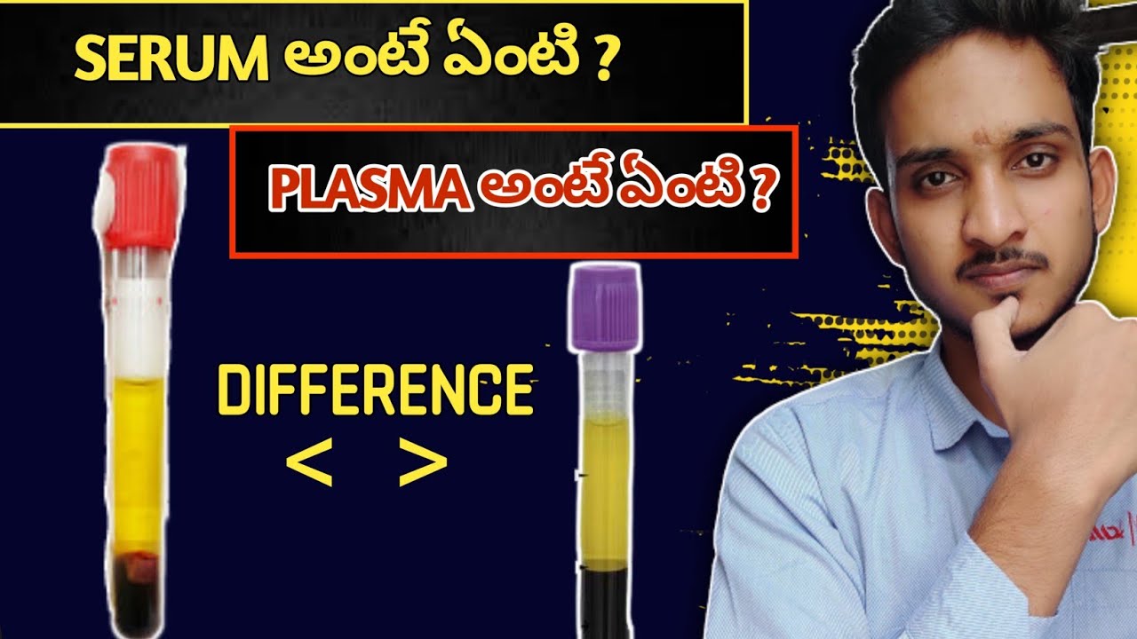 What is The Difference Between Serum And Plasma | what is Serum, What ...