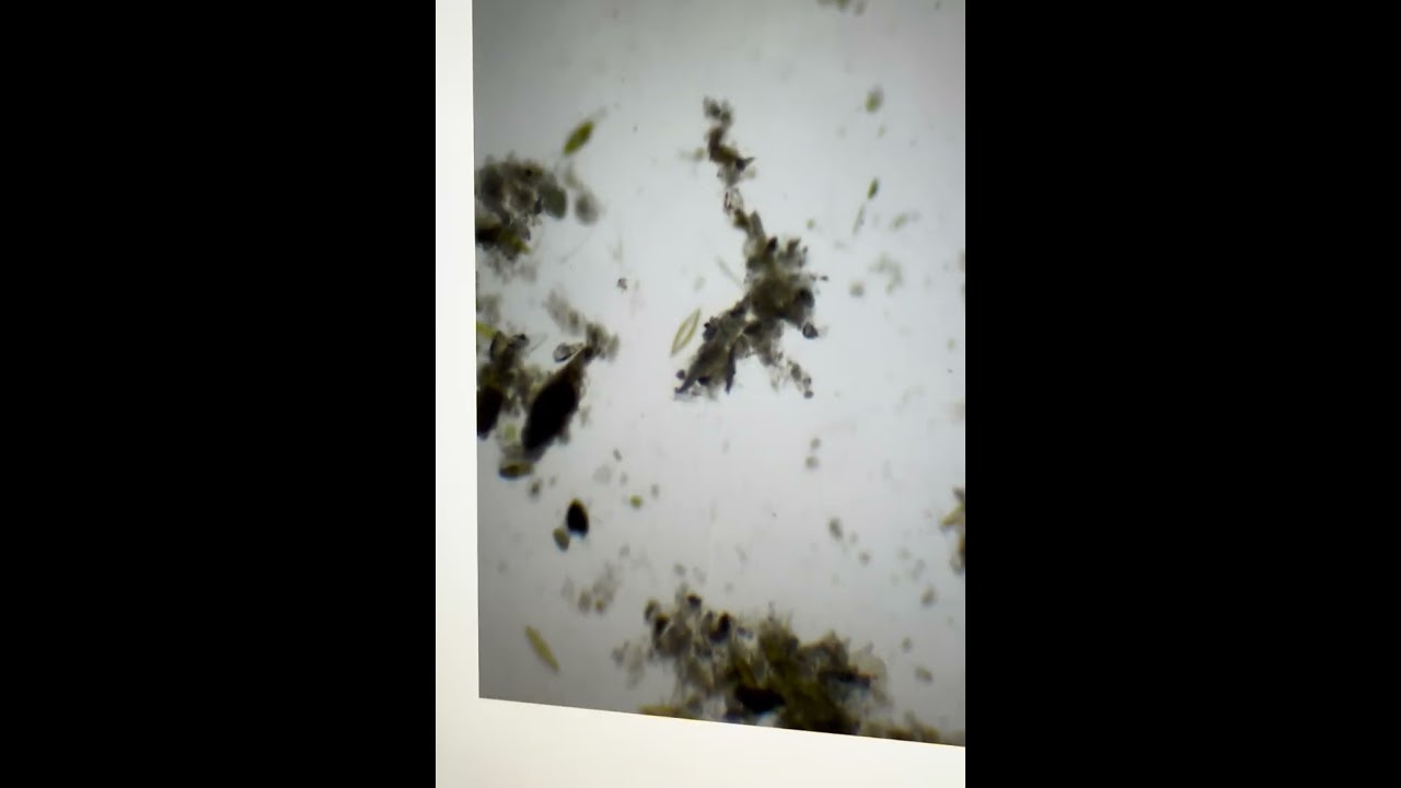 La Vida en una Gota de Agua 💧 🦠🧪🔬 #Science #Biology #Microbiology #Ciencia #Biologia #Microbiologia