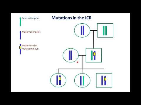 Vidéo: Prévalence Et Facteurs De Risque Du Diabète Sucré De Type 2 Avec Syndrome De Prader – Willi: Une Expérience Monocentrique