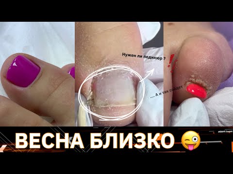 🙈ПЕДИКЮР ЗИМОЙ /ДЕЛАТЬ ИЛИ ПОДОЖДАТЬ ДО ЛЕТО ?