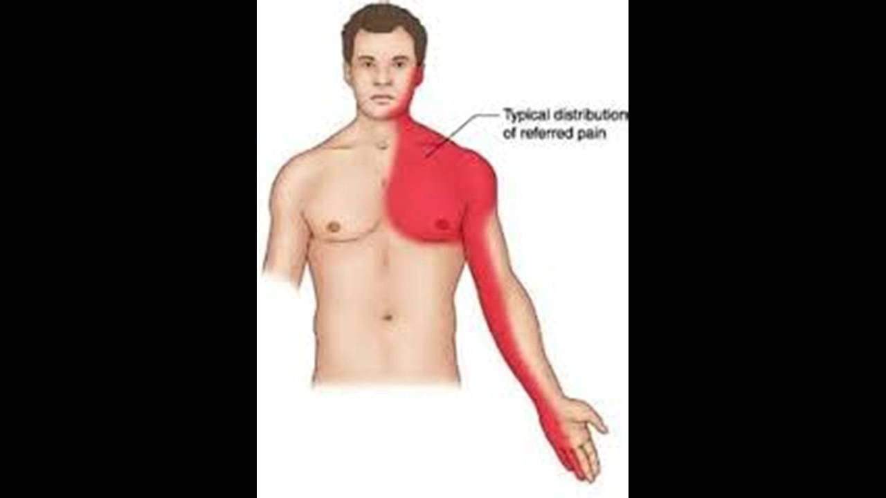 Болит под правой мышкой. Болит Лучеое предплечье. Локализация боли при стенокардии. Боли иррадиирующие в левое плечо.