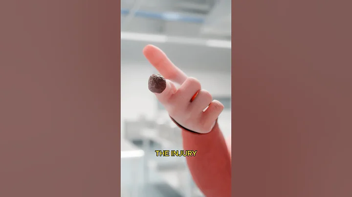 How Kids Can Regrow Fingers 😱 Surgeon Reacts