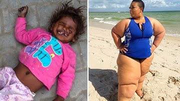 15 meest bizarre mensen waarvan je niet zult geloven dat ze bestaan!