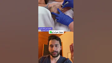 علاج تعرق تحت الابط دكتور يوسف 