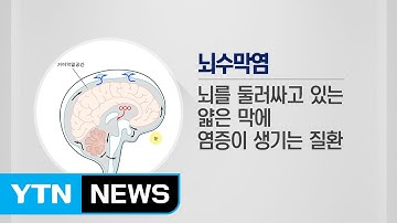 감기 같은, 그러나 치명적인 