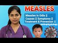 ||Measles disease in odia||Causes||pathophysiology||Symptoms||Treatment & prevention||