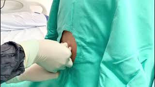Combined Spinal - Epidural analgesia during labour (Part 1)