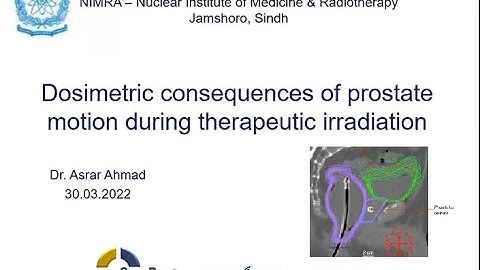 IGRT Technique of Prostate Treatment