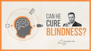 Can This Brain Implant Cure Blindness?