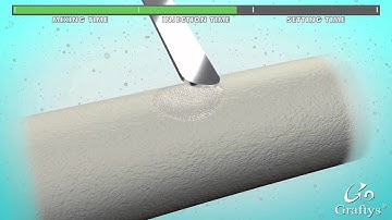 Graftys Setting Reaction synthes3d V5HD