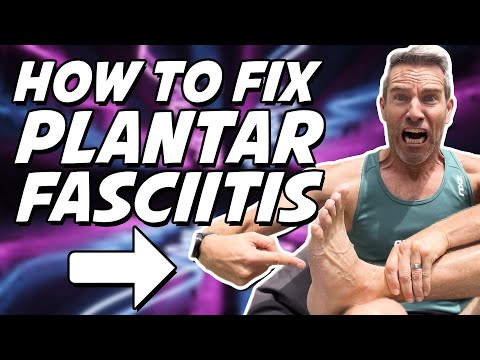 Runners Guide to Plantar Fasciitis Symptoms, Treatment, and Recovery Strategies