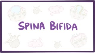 Spina bifida (myelomeningocele, meningocele, occulta)  causes, symptoms, treatment