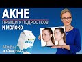 Акне прыщи, черные точки на лице, спине - лечение в домашних условиях. Причины акне у подростков?