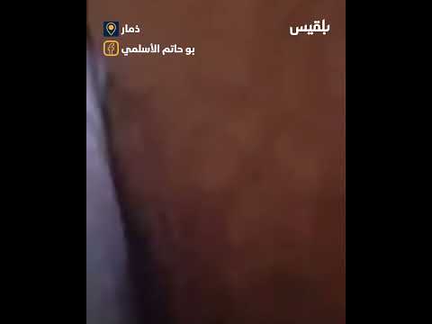 احتجاجات غاضبة في عنس ضد الجبايات