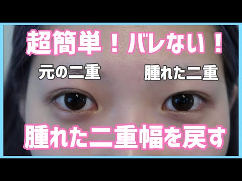 アイプチ 腫れた目でも綺麗な二重は作れる 折式 Youtube