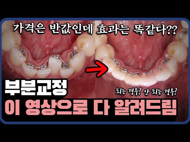 ()부분 교정 전 필수 시청! ㅣ가성비 교정하는 방법