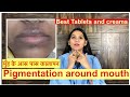 Dark patches around mouth | How to remove pigmentation around mouth and lips |