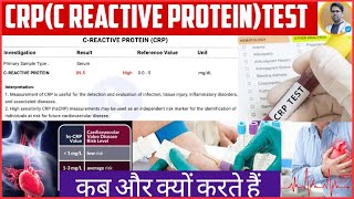 CRP TEST क्या है/CRP TEST कब कराना होता है/CRP TEST से क्या क्या पता चलता है/CRP TEST IN HINDI