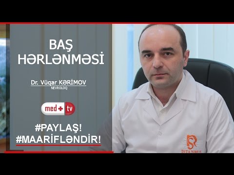 Bas herlenmesi Nevroloq Vuqar Kerimov Medplus TV