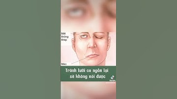 Sơ cứu đột quỵ