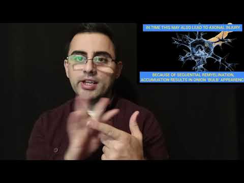 გილენ-ბარეს სინდრომი - მოულოდნელი დამბლა. ინფექციის შემდეგ. მარტივად ახსნილი