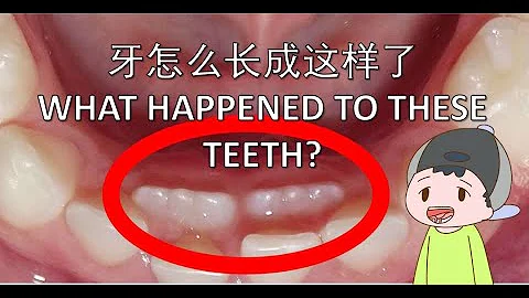 【儿童牙齿】5大最重要的注意事项— 全天下父母必读！5 most important tips for child's teeth health — Parents must watch. - DayDayNews