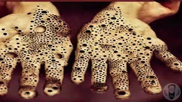 AI GENERATED VIDEO: TRYPOPHOBIA LOOP VIDEO #o5 (STABLE DIFFUSION)