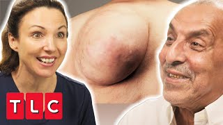 Dr. Emma’s Patient Has 1.2 Kilo Lipoma Removed From His Back! | The Bad Skin Clinic