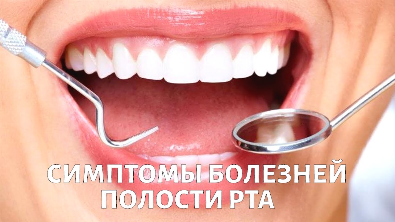 Болезни полости рта. Кровоточивость дёсен, чувствительность зубов, неприятный запах