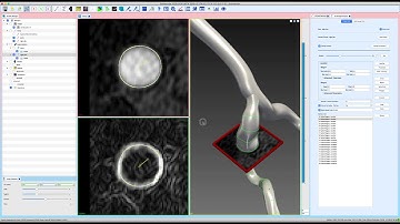 SimVascular Tutorial 3:  2D Segmentations with Level Set and Manual
