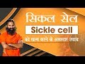   sickle cell        swami ramdev