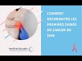 Comment reconnaitre les premiers signes du cancer du sein