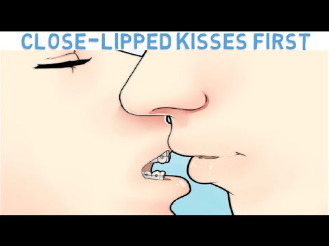 Como beijar com aparelho ortodôntico – Explicação científica