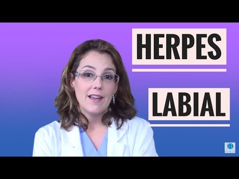 Video: Cómo tratar el herpes labial en la nariz: 13 pasos (con imágenes)