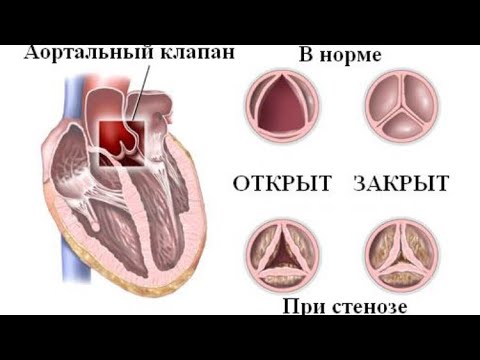 Рено аортальный индекс