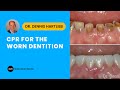 Cpr for the worn dentition course clip  dental online training