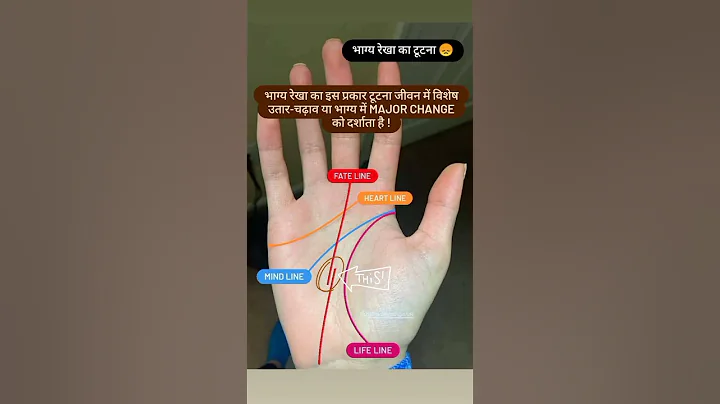 Broken Fate line 😟 | भाग्य रेखा का टूटना | हस्त रेखा | Palm 🖐️ reading #palmistry #shorts