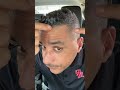 Bald spots and receding hairline and patchy beard #hairtok #hairgrowth