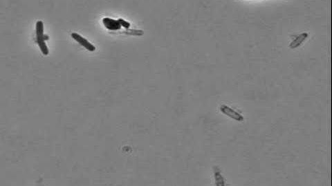 E. coli Cells Explode