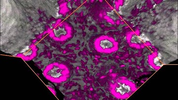 SunJin Lab, RapiClear 1.52: 3D Architecture of Mouse Ileum