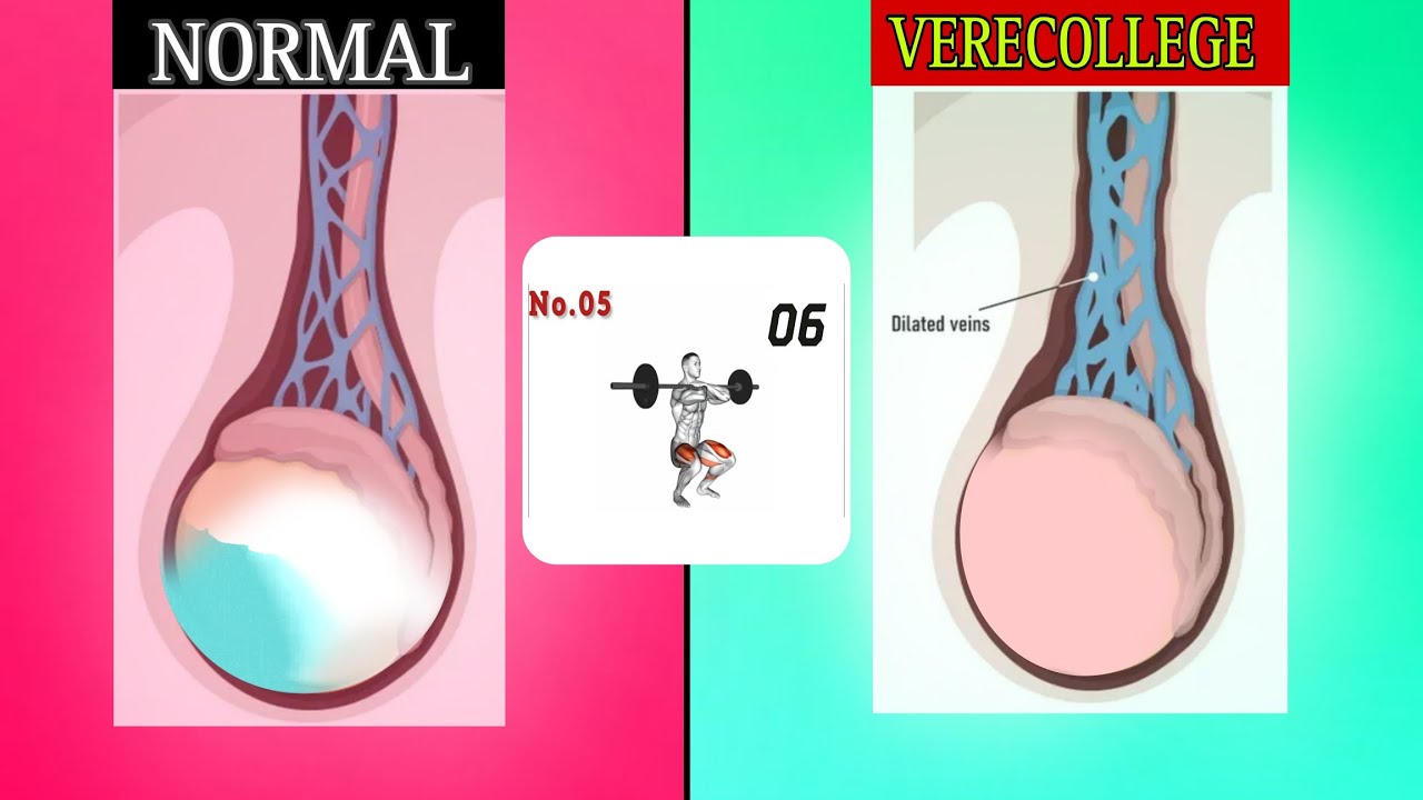 3 Min Best Exercise For Hanging Balls|Fix Your Hanging Balls Every Day