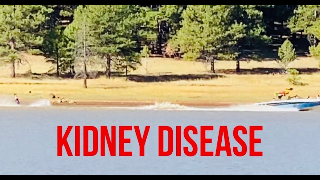Vlog 10 Part 3 Kidney Disease Fishing Flagstaff Arizona YouTube