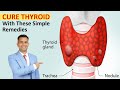 Easy Natural Treatment For Thyroid | Cure Thyroid with These Simple Remedies