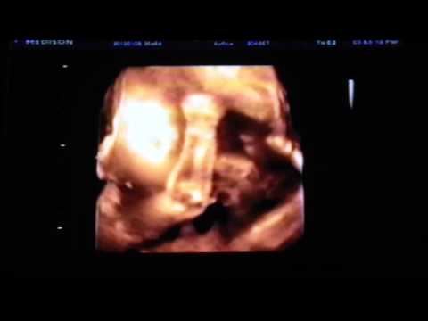 胎児７ヶ月 26週 ４dエコー 1 Youtube